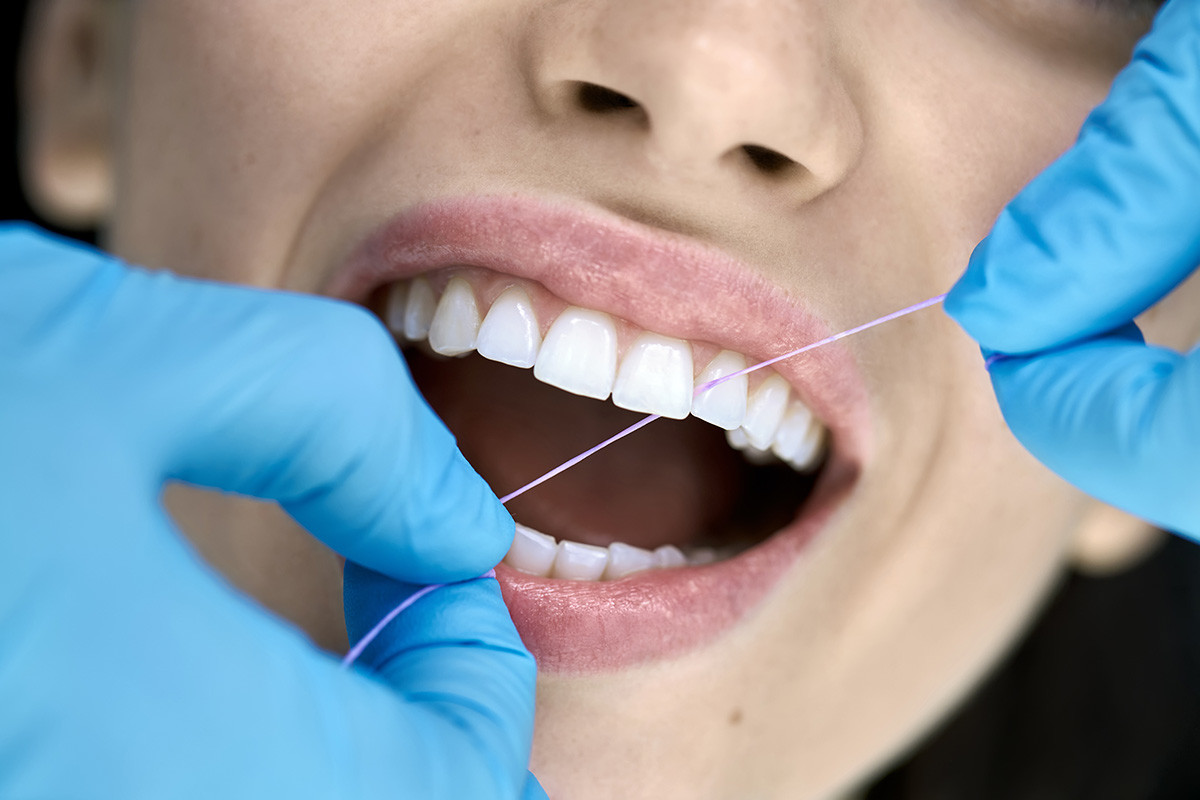 Services Included When Going for an Aesthetic Dental Clinic